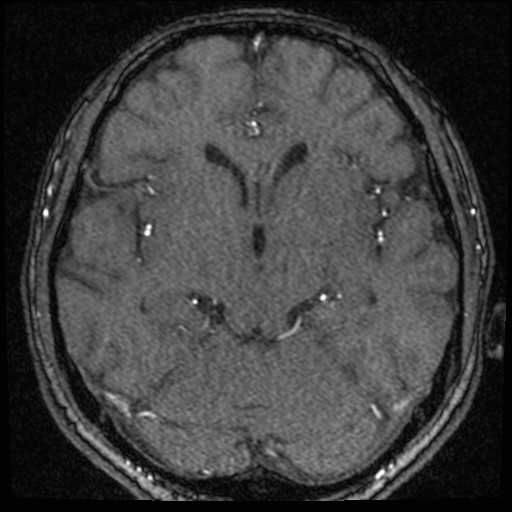 Click on the Serie image to view the images of VILLANUEVA, WILLIAM A.